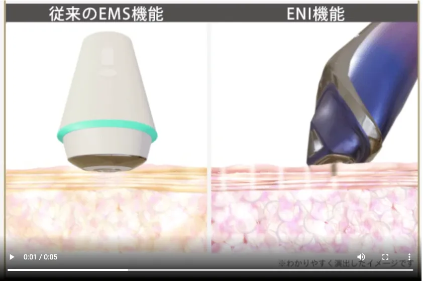 DIMANIのENI機能